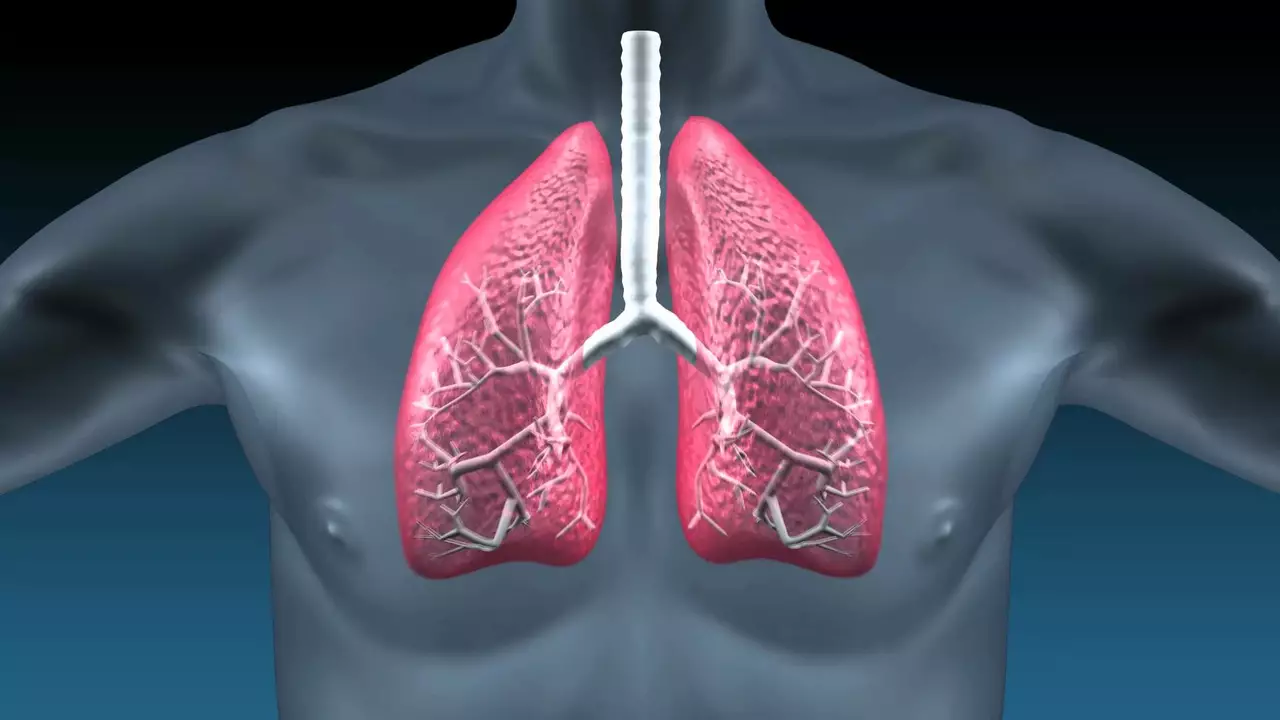 The Importance of Patient Advocacy in the Idiopathic Pulmonary Fibrosis Community